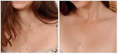 Dermatend reviews Dermatend reviews