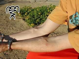 Body Modifications: implanty 8