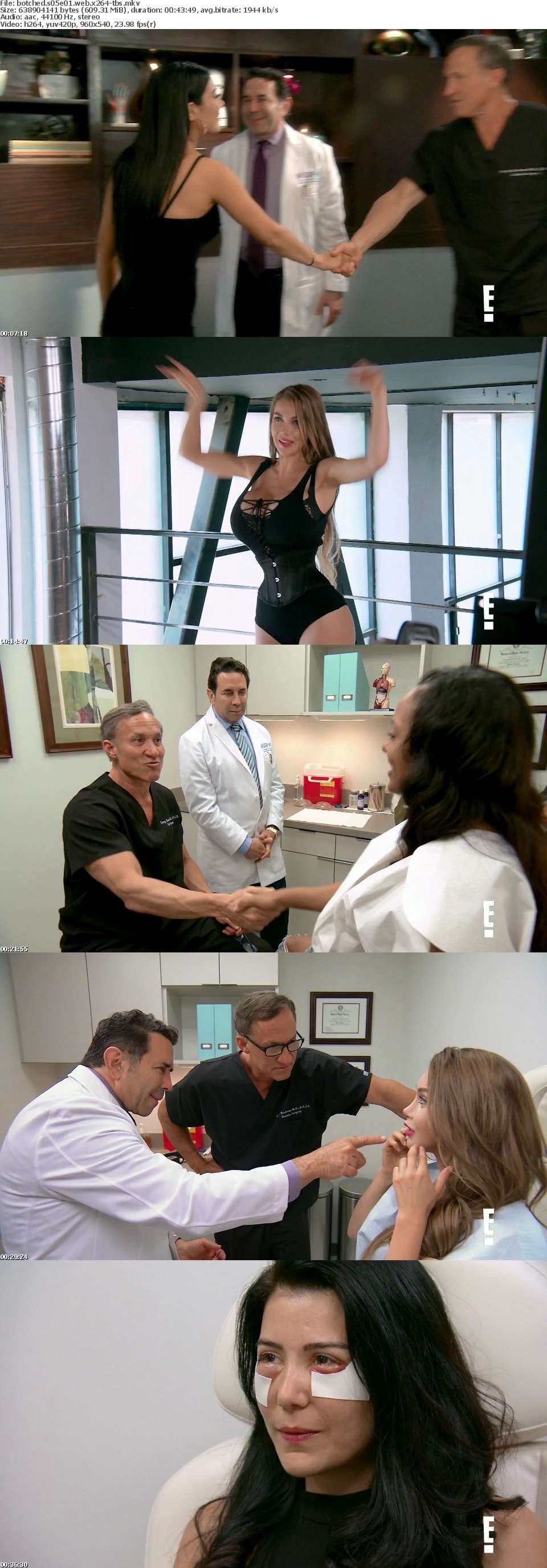 Botched S05E01 WEB x264-TBS Botched S05E01 WEB x264-TBS