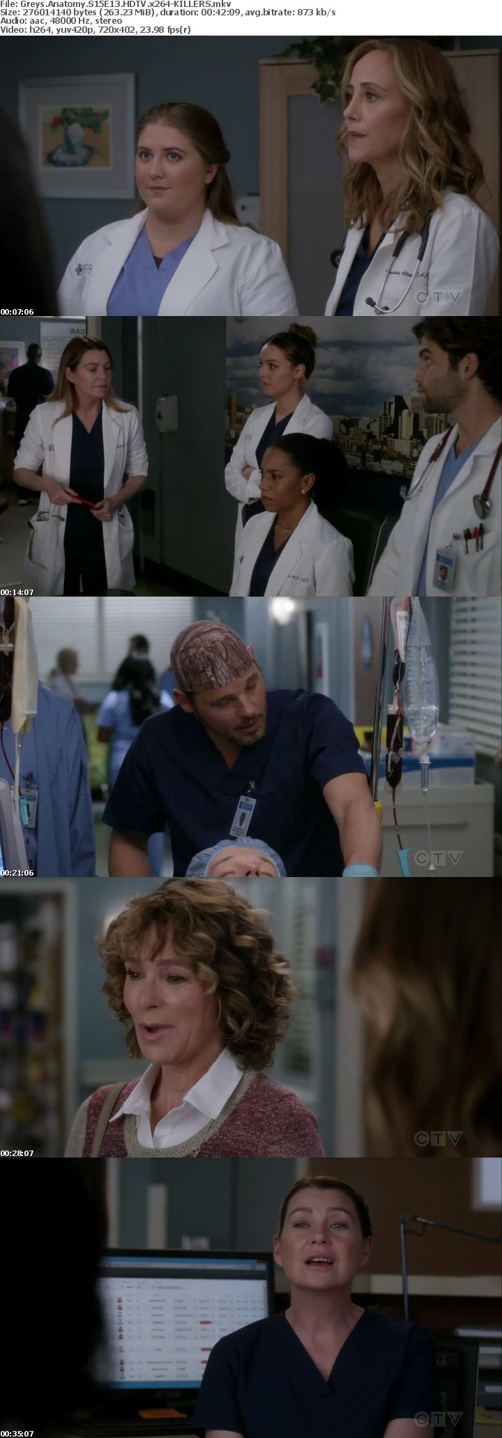 Greys Anatomy S15E13 HDTV x264-KILLERS Greys Anatomy S15E13 HDTV x264-KILLERS