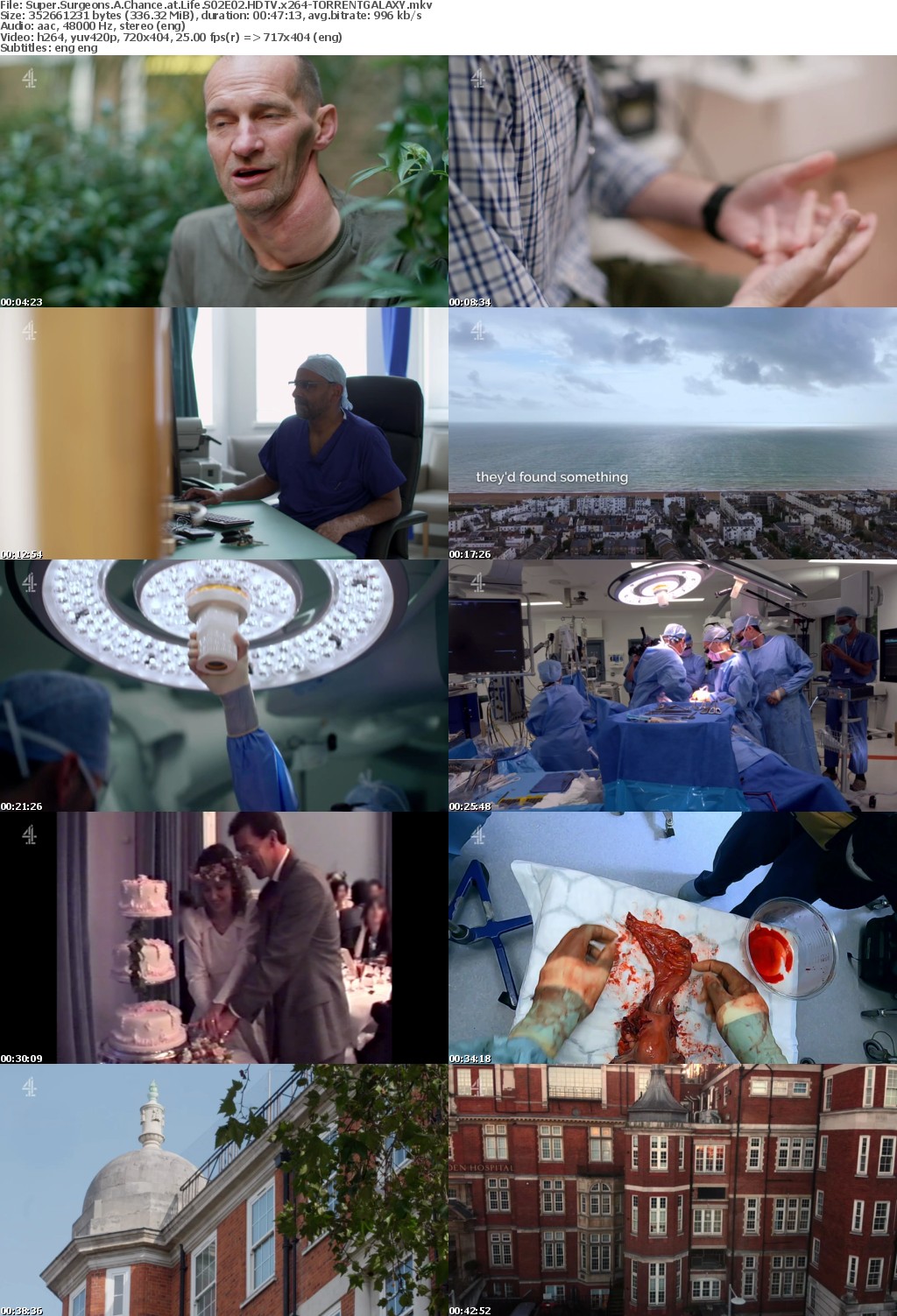 Super Surgeons A Chance at Life S02E02 HDTV x264-GALAXY